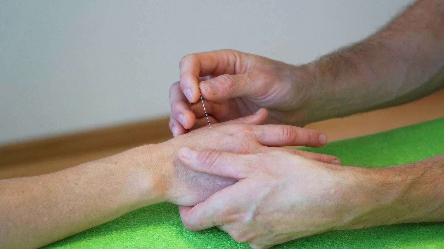 Dry Needling Interossi