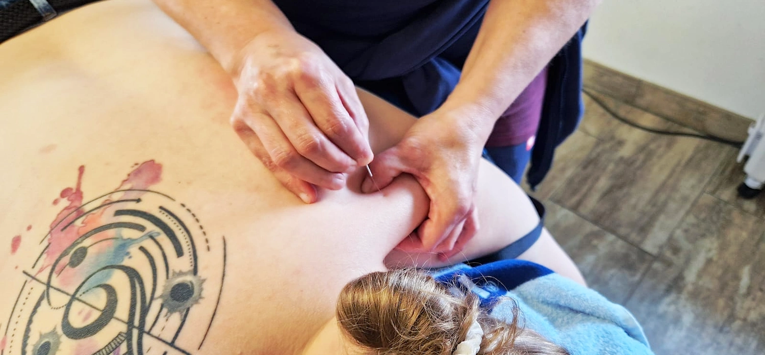 Dry Needling Austria