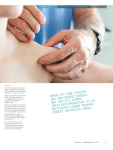Dry Needling Inform